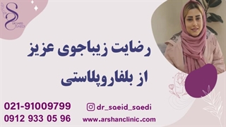 رضایت زیباجوی عزیز از بلفاروپلاستی