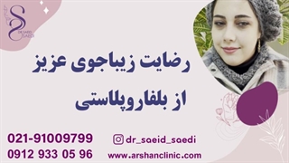 رضایت زیباجوی عزیز از بلفارو پلاستی