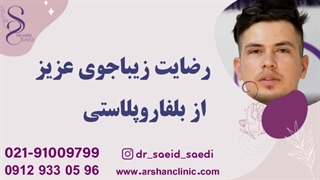 رضایت زیباجوی عزیز از بلفاروپلاستی