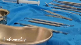 جراحی ایمپلنت مشتری گرامی سرفرازی دندانپزشکی دکتر علی ممتازی