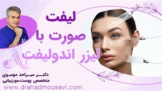 لیفت صورت با لیزر اندولیفت