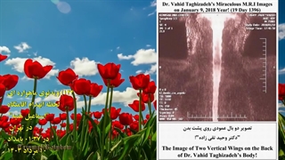 144) ویدئوی ماهواره ای لحظه انهدام اقامتگاه اسماعیل هنیه در تهران در ساعت 01:37 بامداد مورخه 10 مرداد 1403 - دکتر وحید تقی زاده زیبایی پوست