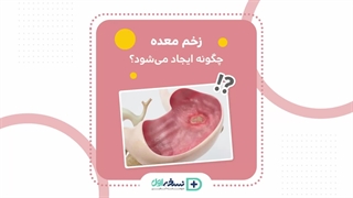زخم معده - داروخانه آنلاین نسخه اول - داروخانه اینترنتی نسخه اول