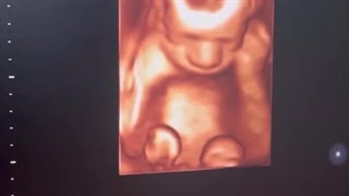 دکتر بابایی؛ سونوگرافیست بندرعباس