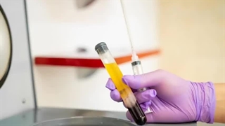 کیت پی آر پی مو PRP HAIR KIT خرید و قیمت 09126851758