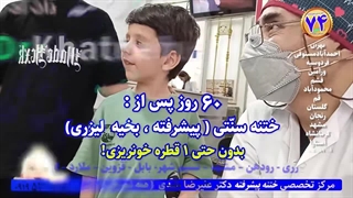 فیلم ختنه لیزری بدون بیهوشی بدون درد درحضور والدین استاد دکتر بلندی