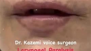 دکتر کاظمی بهترین جراح حنجره