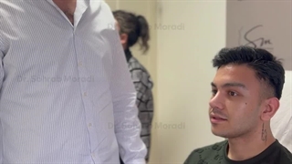 عمل زیبایی بینی، لیفت اندوسکوپی ابرو بوکال فت