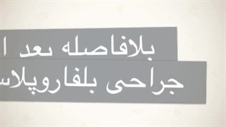 منا اسدی