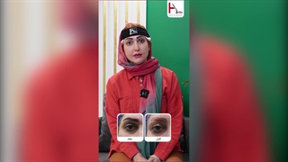 تجربه شخصی من از کاشت ابرو: از ترس تا رضایت