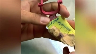 دندان سازی پارسیان ساری