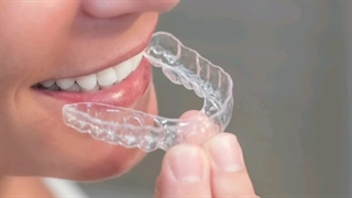 نقاط ضعف الاینر ۲ (ارتودنسی نامرئی)