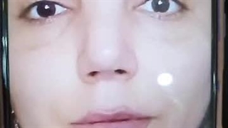 فیلر لب نچرال