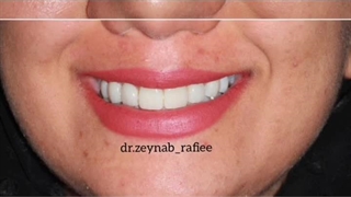 دندان پزشک زینب رفی ساری