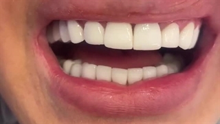 دندان پزشک حسین بشیری ساری