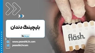 فیلم بلیچینگ دندان (سفید کردن دندان) آکنه