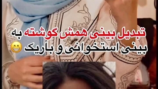 دکتر حمیدرضا زنگنه لیفت صورت