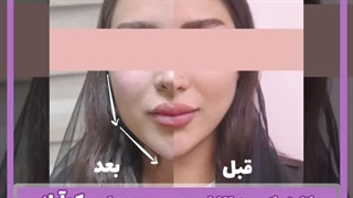 کانتورینگ صورت چیست؟ کشیدن دندان