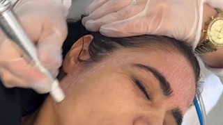 کلینیک پوست و کاشت مو و لیزر موهای زائد تندیس کلینیک دندانپزشکی