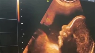 سونوگرافی دکتر بابایی -بندرعباس