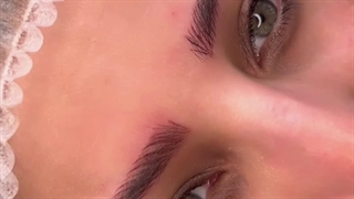 فیبروز ابرو