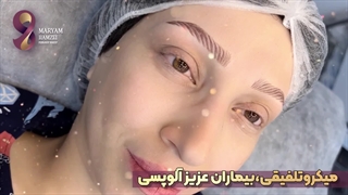 میکروتلفیقی در مرکز آرایش دائم مریم حمزه ای