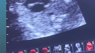 دکتر سید حسن شریفی