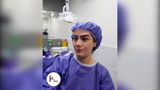 کاشت ابرو ، انتخاب مدل مناسب برای هر چهره