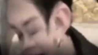 بنگ چان داره کچل میشه؟