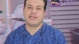 ایمپلنت چیست؟