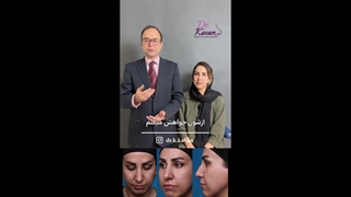 رضایت زیباجو از عمل زیبایی بینی