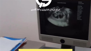 مرکز ناباروری گاندی