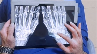 رادیولوژی در منزل - در تهران و کرج - گاما پرتو