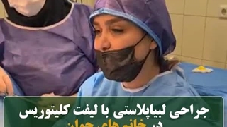 هزینه جراحی لابیاپلاستی در سال 1403 کربوکسی تراپی