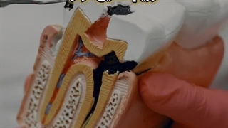 روش های مراقبت از مینای دندان چیست؟