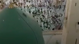 رَحمَةًلِلعٰلَمین (خجسته میلاد پیامبر اکرم) جراحی بینی
