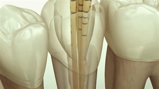 موتور روتاری Eigheeth مدل E Connect pro