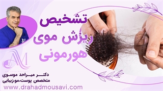 میدونید علت اصلی ریزش موهاتون چیه