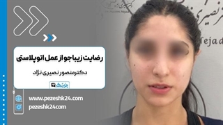 جراحی اتوپلاستی با دکتر منضور نصیری نژاد در تهران لیزر مو