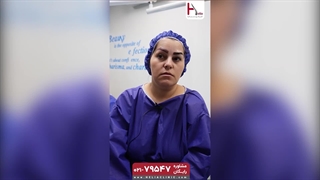 تجربه کاشت ابرو بدون جراحی