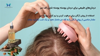 پوسته پوسته شدن کف سر