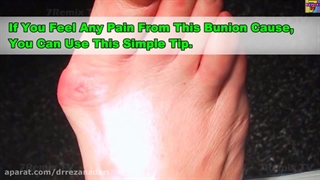 درمان قوز شست پا در طب سنتی