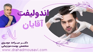لیزر اندولیفت آقایان بهترین راه جوانسازی