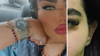 رفع الحاجب بالمنظار