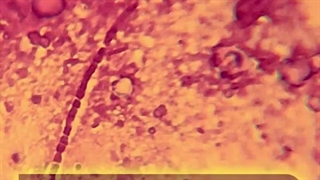 جیکو عروس هلندی از ملکان / کلینیک پرندگان میاندوآب