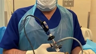 درمان تنگی مجرای ادرار با روش آندوسکوپی