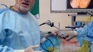 درمان طلایی سنگ های شاخه گوزنی