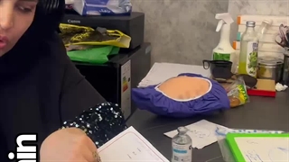 آموزش ساکشن چربی غبغب ساکشن غبغب