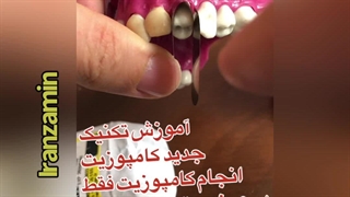 آموزش کامپوزیت دندان مجازی