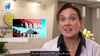 مقایسه لمینت و کامپوزیت دندان، کدام روش بهتر است؟